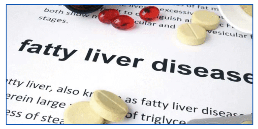 Fatty Liver Disease