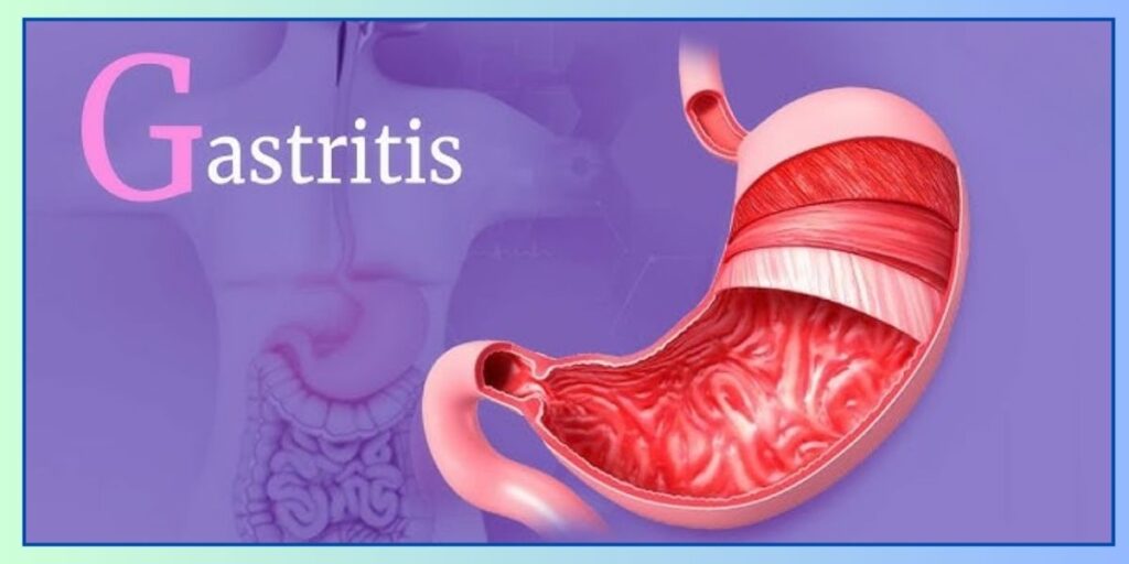 Symptoms of Stomach Problems