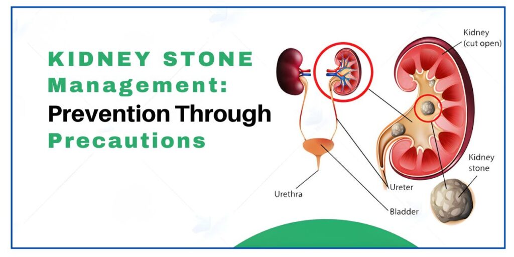 Chronic kidney stones