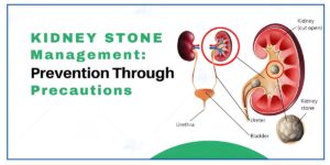Chronic kidney stones