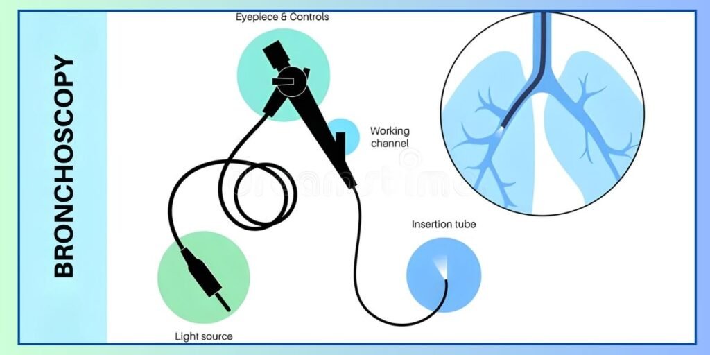 Bronchoscopy Near Me