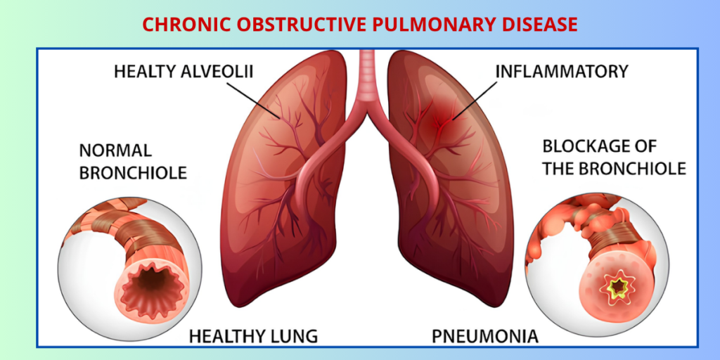 Pulmonologist Near Me