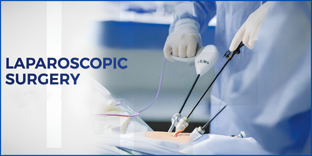 Laparoscopy Near Me
