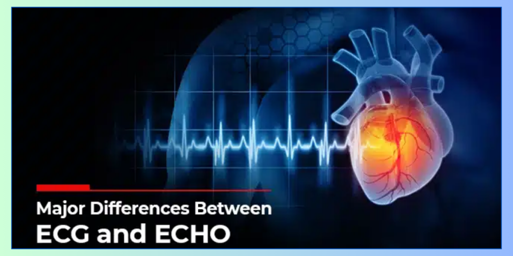 ECHO and ECG Near Me