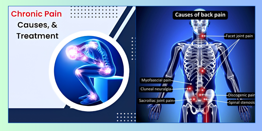 How to manage chronic nerve pain