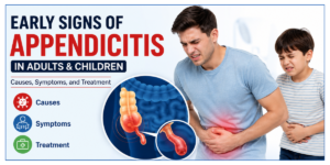 Early Signs of Appendicitis in Adults, and Children