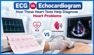 ECG vs Echocardiogram